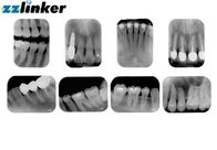 17 Lp/Mm Resolution Dental Intraoral Scanner 14 Bit Gray Level Small Size