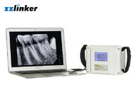 Oral Medical 20KHz LCD 7800mAh 80W Dental X Ray Unit